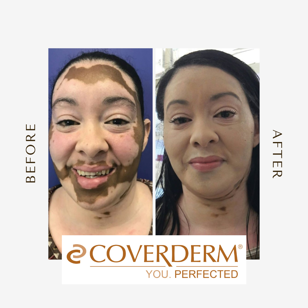 Grey Minimalist Before After Beauty Instagram Post